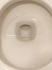 Toilet Bowl Cleaner Starter Set